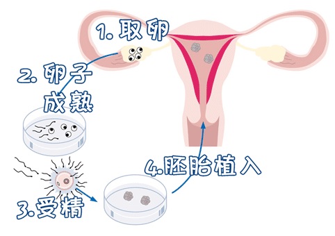 锦书生殖